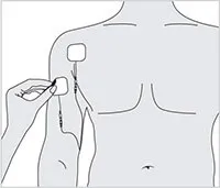 How to remove electrode pads after use